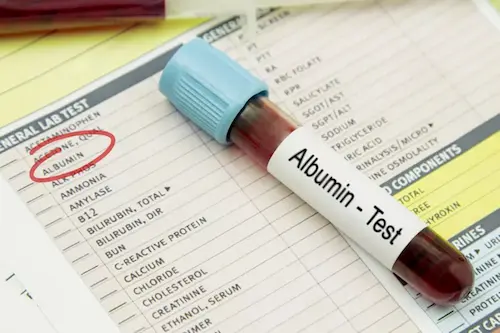 Albumin test image
