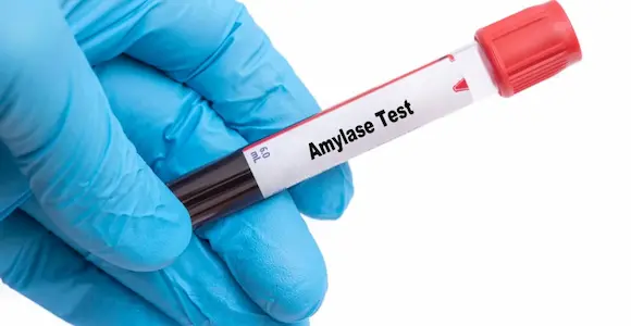 Amylase image