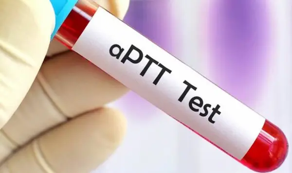 APTT image
