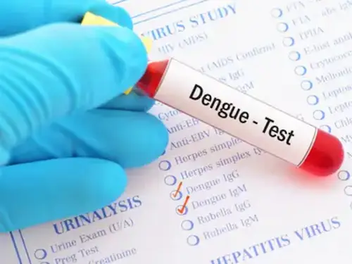 Dengue NS1