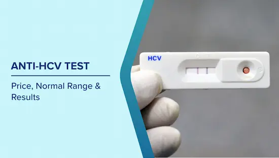 HCv Test