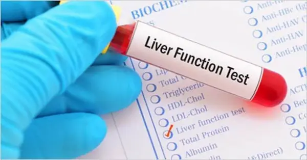Liver function test image
