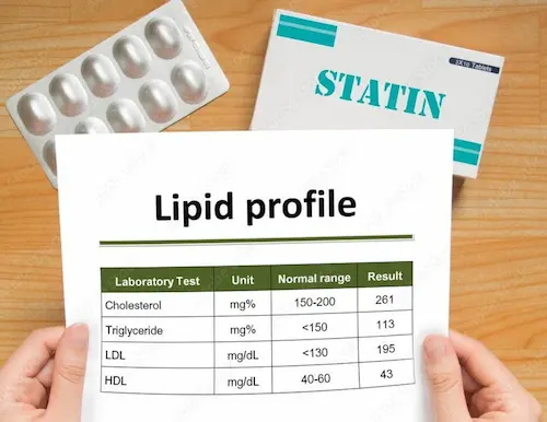 Lipid Test