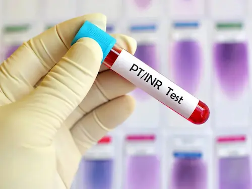 Platelet count image