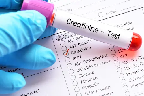 Serum Creatinine