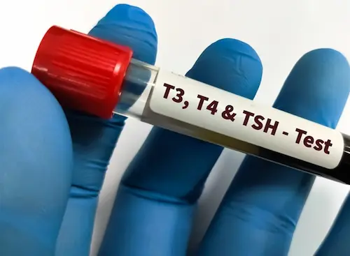 T3 test image