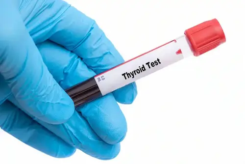 Thyroid test category image