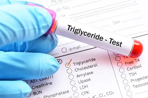 Triglycerides Test