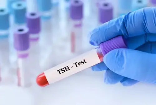 TSH test image