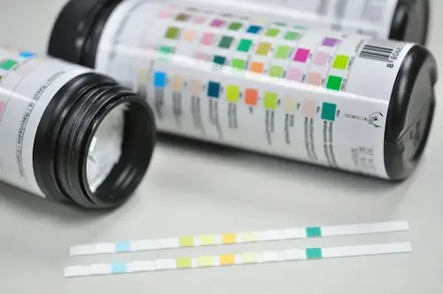 Urine Sugar Test