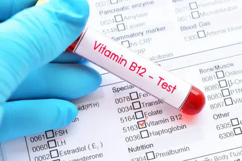 Vitamin B12 test image