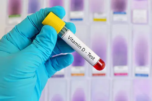 Vitamin D test image