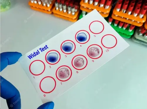 Widal test image